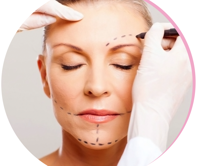 Surgical Face-lift